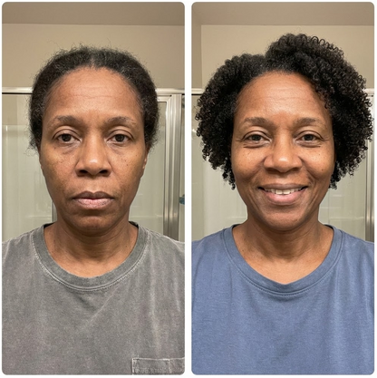 Flxbryte Hair Restoration Roller